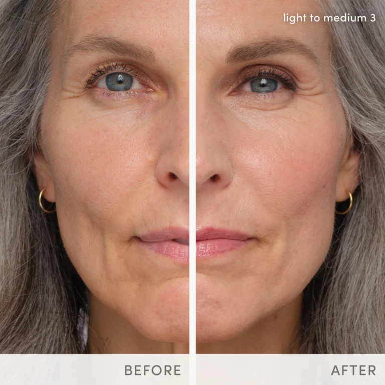 Model HydroPure Light To medium 3